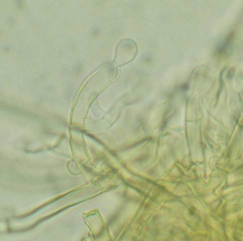 Amphinema byssoides? (Amphinema byssoides)